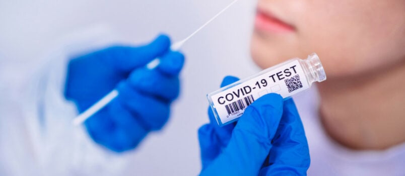 Ανώτατες τιμές χρέωσης για τα τεστ κορονοϊού PCR και rapid test