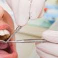 Δωρεάν οδοντιατρικές εξετάσεις