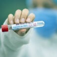 Self test δημοσίων υπαλλήλων για τον Αύγουστο 2021