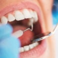 Δωρεάν υπηρεσίες από ιδιώτες οδοντιάτρους σε νοσοκομεία