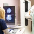 Δωρεάν εξετάσεις μαστογραφίας με συνταγογράφηση